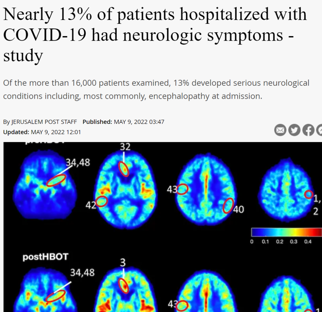 近13%的新冠住院患者出现了严重的神经系统疾病，包括常见的脑病