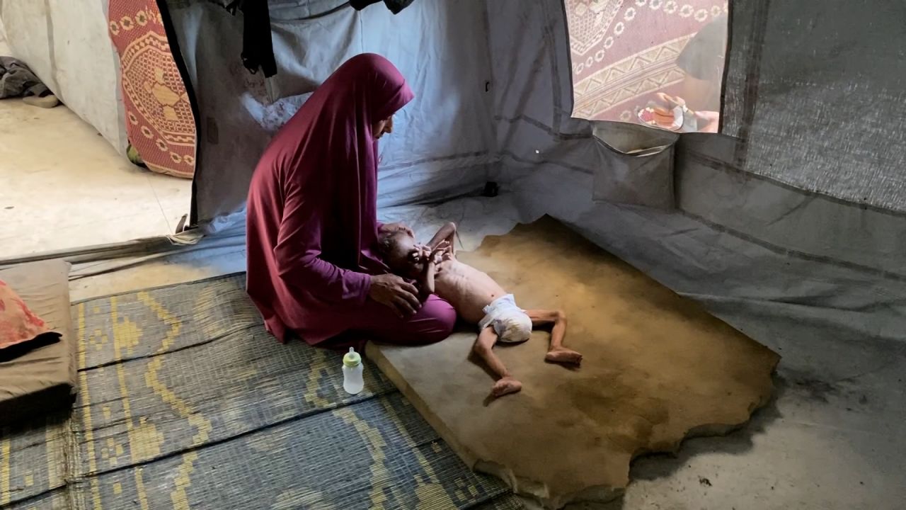 周五，希达亚·姆塔瓦克 （Hidaya Al Mtawwaq） 在加沙城照顾她的儿子穆罕默德